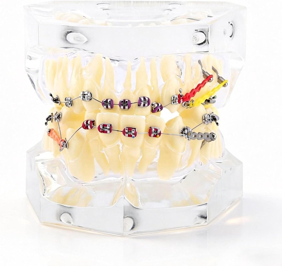 Dental model malocclusie - standaard tandenmodel - resin tanden met draadketting - voor tandheelkundige educatie - ShopVlot