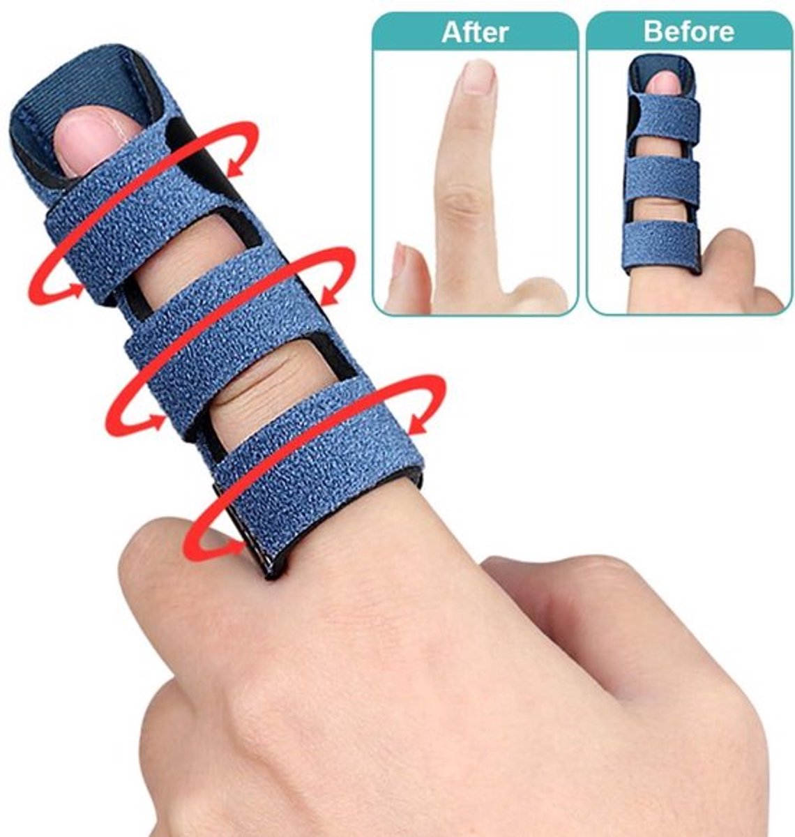 Vingerspalk Allecto Plus - 3-delig voor verstuiking