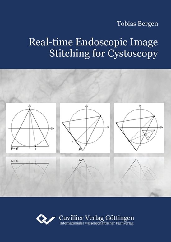 Real-time Endoscopic Image Stitching for Cystoscopy - cover