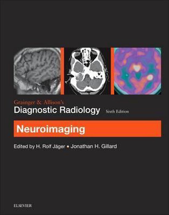 Foto: Grainger allison s diagnostic radiology neuroimaging