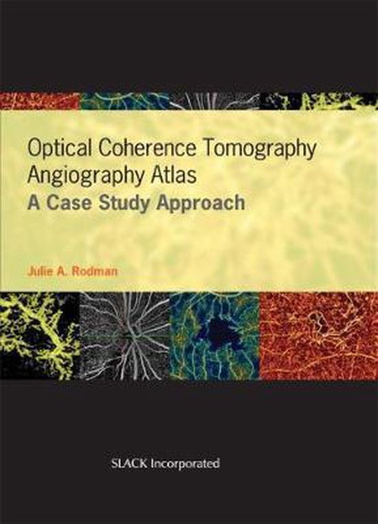 Optical Coherence Tomography Angiography Atlas 9781630916411 Julie
