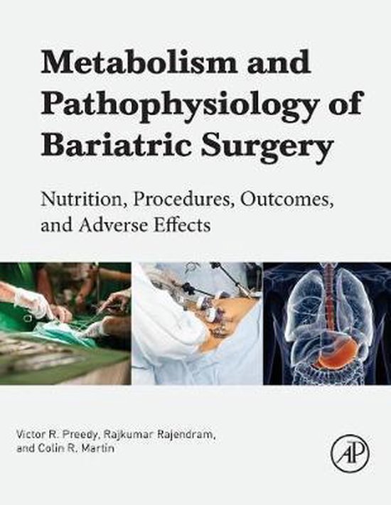 Metabolism and Pathophysiology of Bariatric Surgery 9780128040119