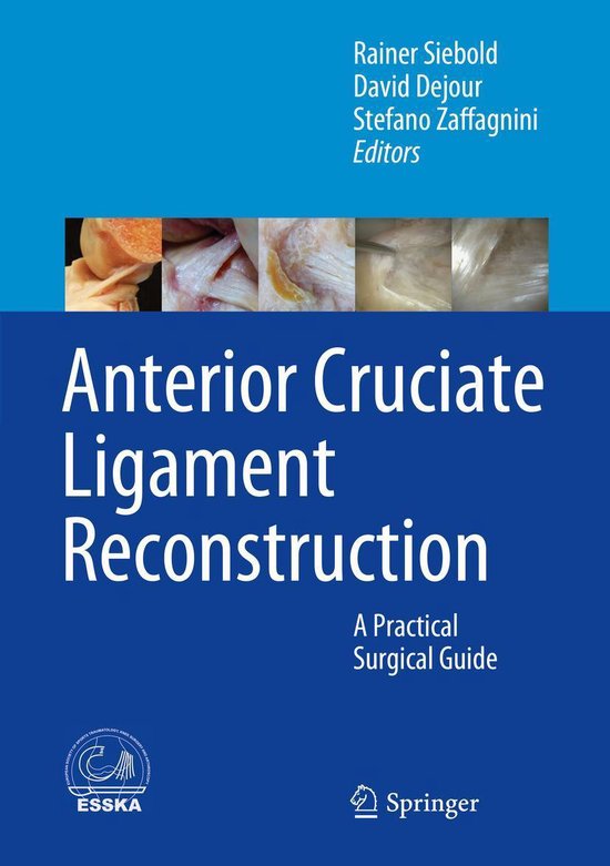 Medicine (R0) - Anterior Cruciate Ligament Reconstruction - cover