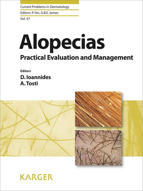 Alopecias - Practical Evaluation and Management - cover