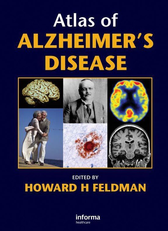 Atlas of Alzheimer's Disease - cover