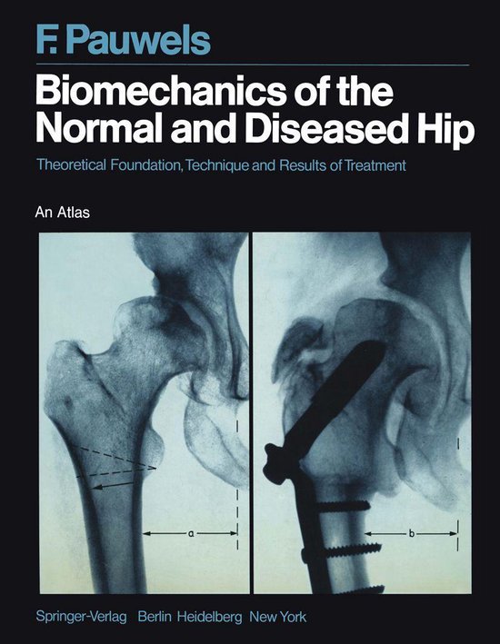 Medicine (R0) - Biomechanics of the Normal and Diseased Hip - cover
