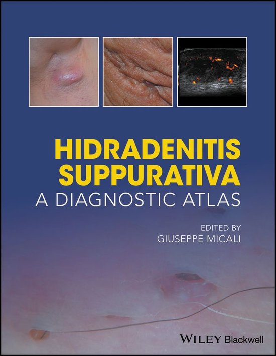 Hidradenitis Suppurativa - cover
