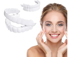 2. Klikfacings: Comfortabele en nauwsluitende witmakende klikfacings voor zowel mannen als vrouwen, die uw glimlach en gebit verbeteren en u een prachtige uitstraling geven op feestjes.