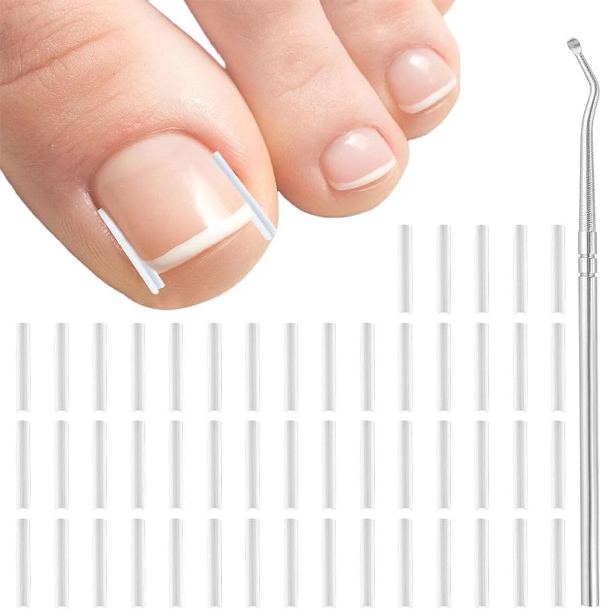 51-delige set voor het corrigeren van ingegroeide teennagels - pijnloze nagelcorrectie en nagelverzorging