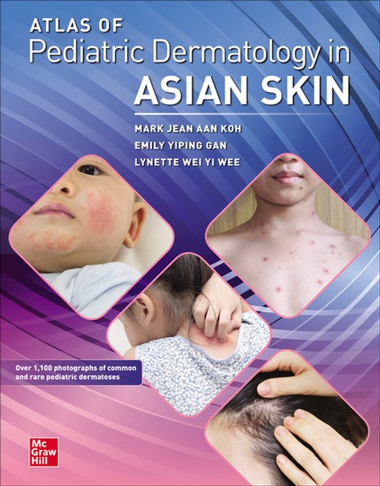 Atlas of Pediatric Dermatology in Asian Skin - cover