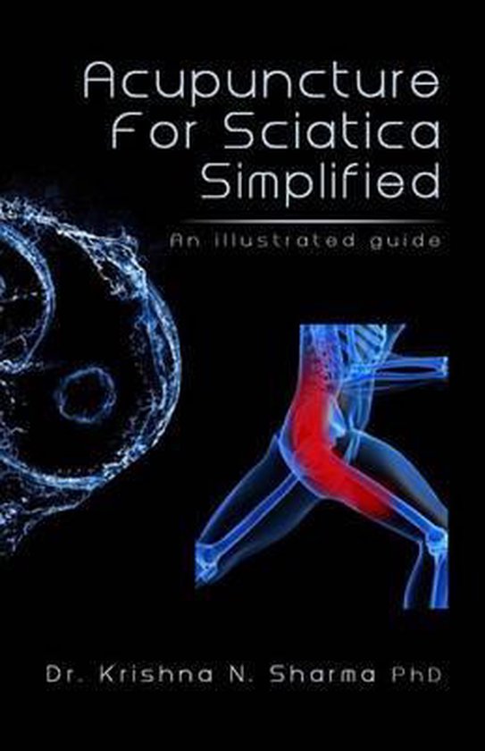 Acupuncture for Sciatica Simplified, Krishna N. Sharma 9781492741091