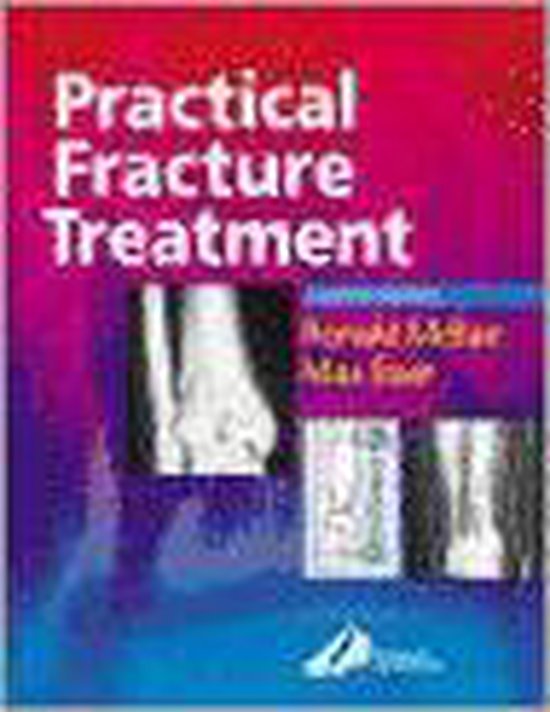 Practical Fracture Treatment - cover