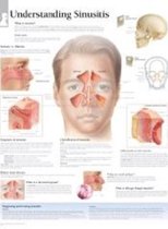 Understanding Sinusitis