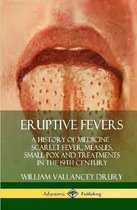 Eruptive Fevers