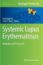 Systemic Lupus Erythematosus