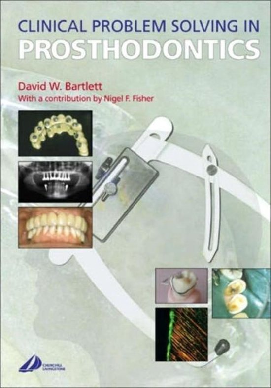 Clinical Problem Solving in Prosthodontics | 9780443072826 | David ...