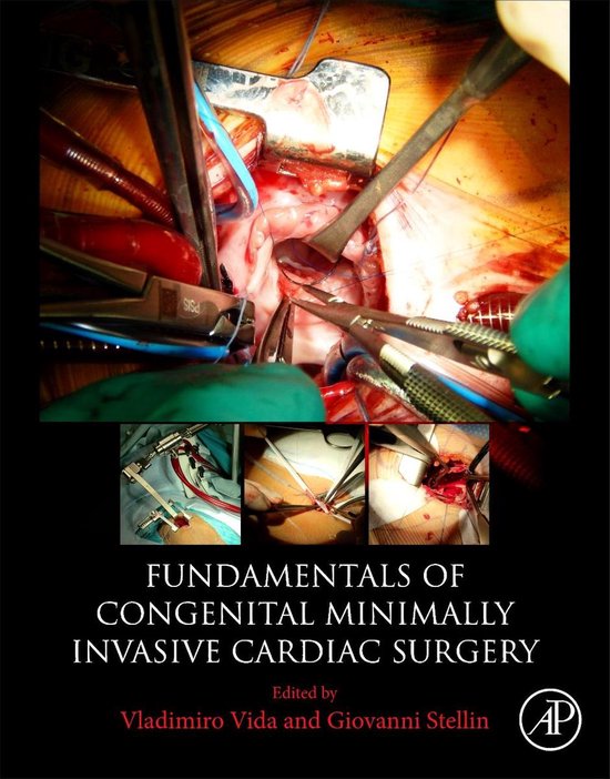 Fundamentals of Congenital Minimally Invasive Cardiac Surger ... - cover