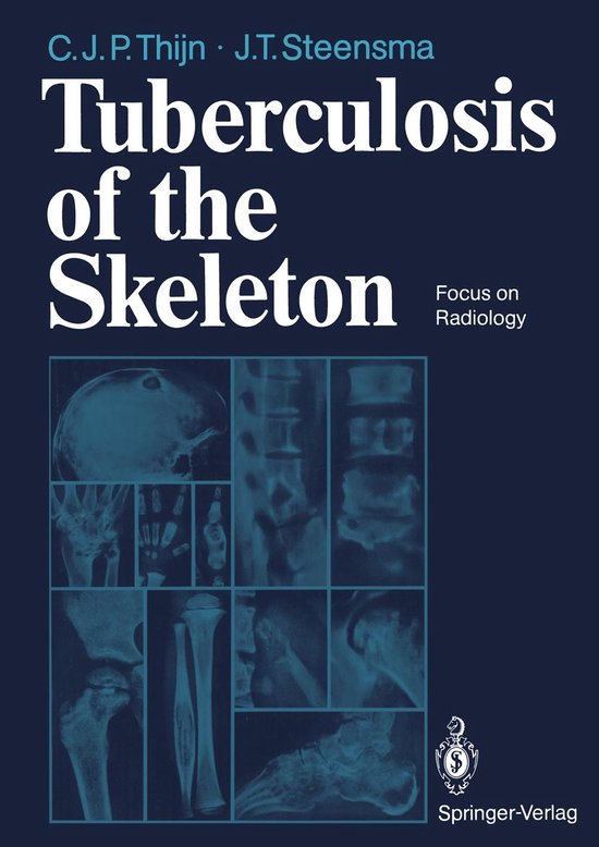 Medicine (R0) - Tuberculosis of the Skeleton - cover