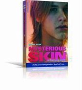 Mysterious Skin