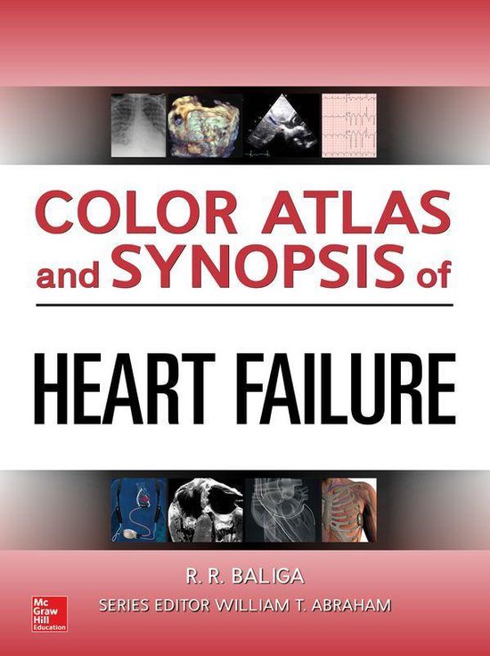Color Atlas and Synopsis of Heart Failure - cover