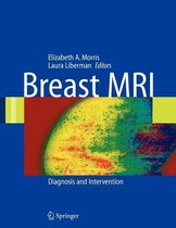 Breast MRI