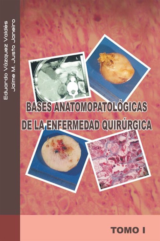 Bases Anatomopatológicas De La Enfermedad Quirúrgica - cover