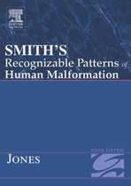 Smith's Recognizable Patterns of Human Malformation