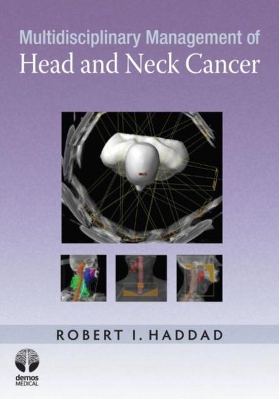 Multidisciplinary Management of Head and Neck Cancer 9781933864556