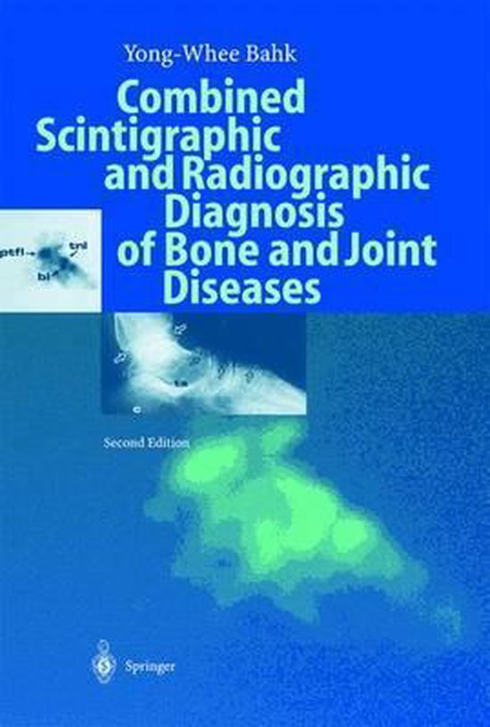 Combined Scintigraphic and Radiographic Diagnosis of Bone an ... - cover