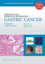 Advances in Surgical Pathology - Advances in Surgical Pathology: Gastric Cancer