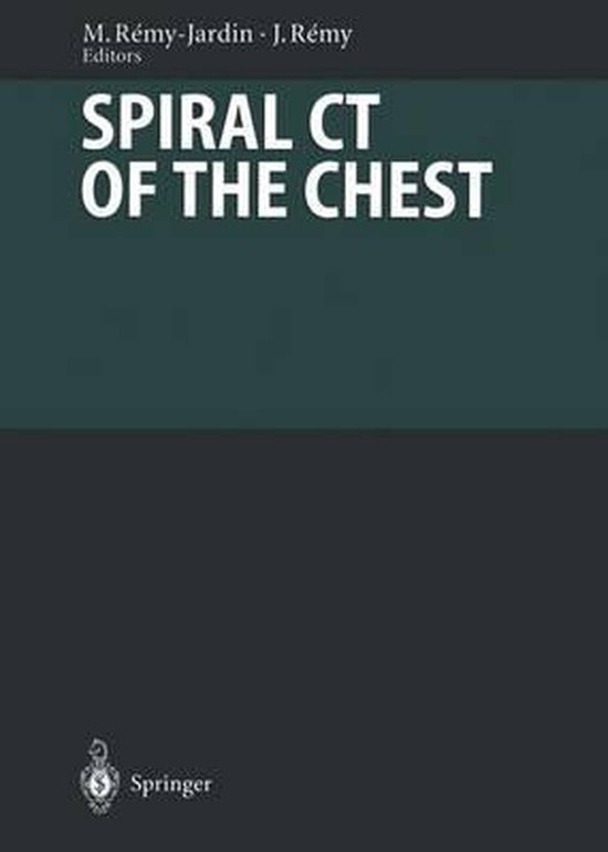 Spiral CT of the Chest - cover