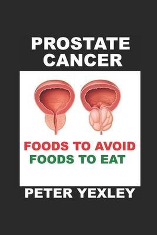 Prostate Cancer. Foods to Avoid. Foods to Eat., Peter Yexley ...