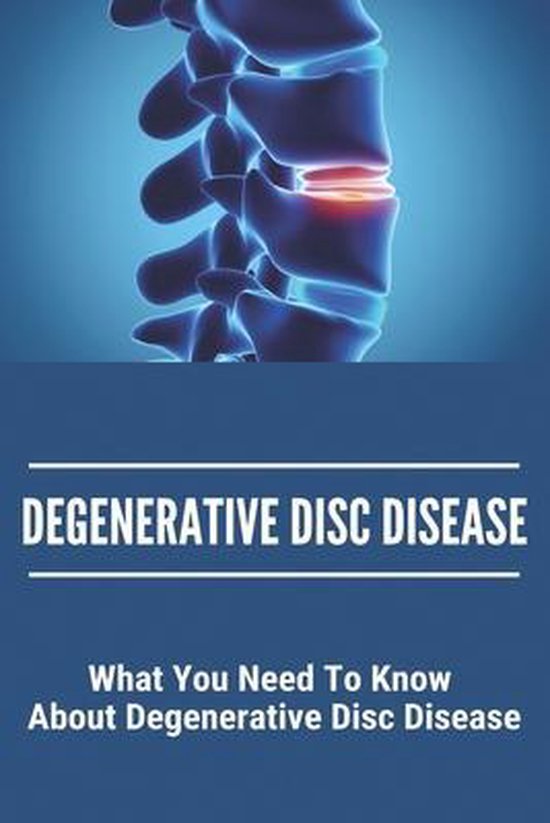 Degenerative Disc Disease What You Need To Know About Degenerative