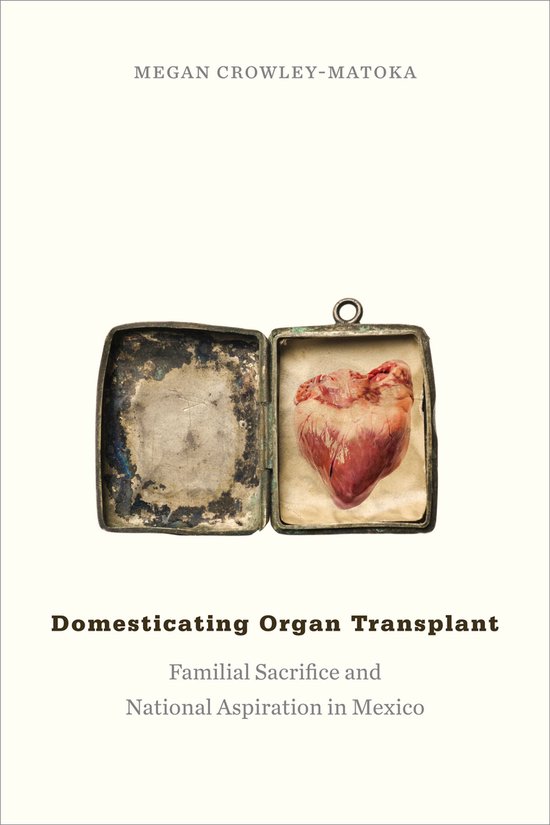 Foto: Domesticating organ transplant