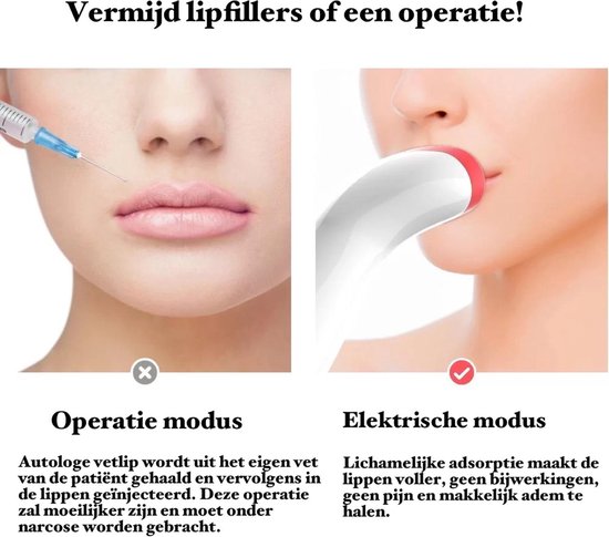 BenjaBeauty les Repulpeur de lèvres ®|Lèvres plus pulpeuses|lèvres|Lèvres...  | bol.com
