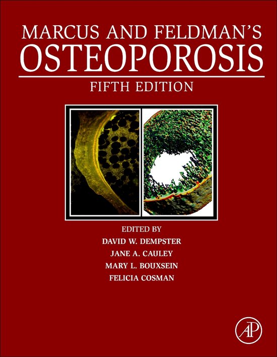 Marcus and Feldman's Osteoporosis - cover