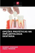 Opcoes Proteticas Na Implantologia Dentaria