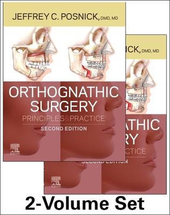 Orthognathic Surgery - 2 Volume Set - cover