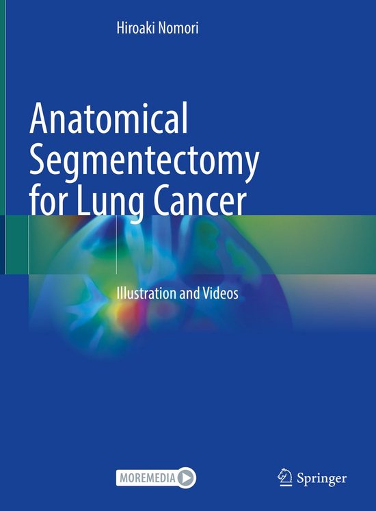 Anatomical Segmentectomy for Lung Cancer - cover