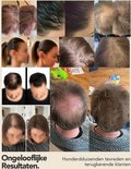 Collage met onvoorstelbare resultaten van IMPERIO haarvezels. Diverse voor en na foto's van hoofdhuid en haar, met diverse leeftijden en haarkleuren. Honderden tevreden klanten.