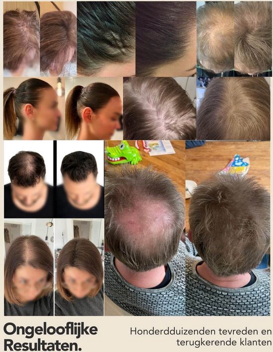 Collage met onvoorstelbare resultaten van IMPERIO haarvezels. Diverse voor en na foto's van hoofdhuid en haar, met diverse leeftijden en haarkleuren. Honderden tevreden klanten.
