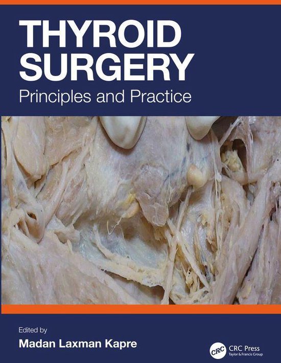Thyroid Surgery - cover