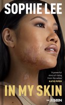 Katie Piper's The UnSeen- In My Skin