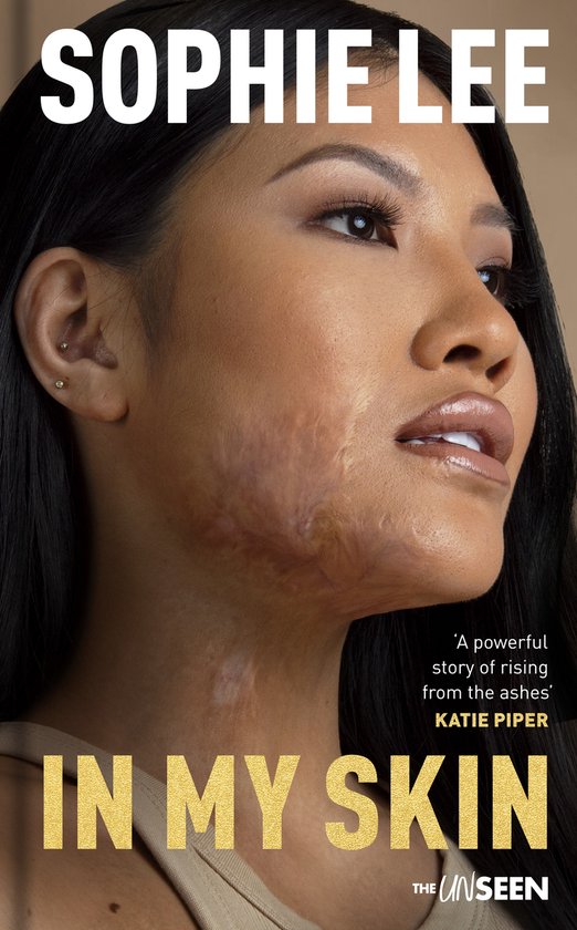 Couverture de livre avec gros plan de Sophie Lee, cicatrices visibles sur son visage. Texte : 'SOPHIE LEE IN MY SKIN THE UNSEEN'