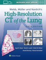 HIGH-RESOLUTION CT OF THE LUNG 6E CB
