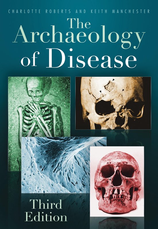 The Archaeology of Disease - cover