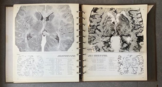 Atlas de la Vascularisation arterielle du cerveau chez l'homme
