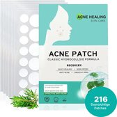 ACNE HEALING - Pimple Patches - Puisten Pleister - Acne Pleister - Puisten verwijderaar - Acne Sticker - Pimple patch - pimple patches - 216 STUKS