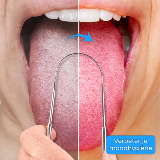 Nuvance Professionele Tongschraper - 3 in 1 Set - voor Mondverzorging - Tongreiniger - Tong Schraper - Tongue Scraper - RVS