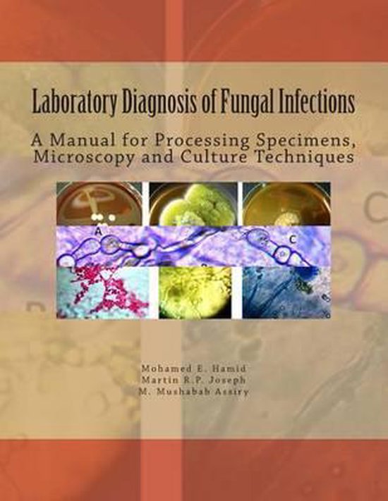 Laboratory Diagnosis of Fungal Infections, Dr Mohamed E Hamid